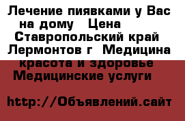Лечение пиявками у Вас на дому › Цена ­ 200 - Ставропольский край, Лермонтов г. Медицина, красота и здоровье » Медицинские услуги   